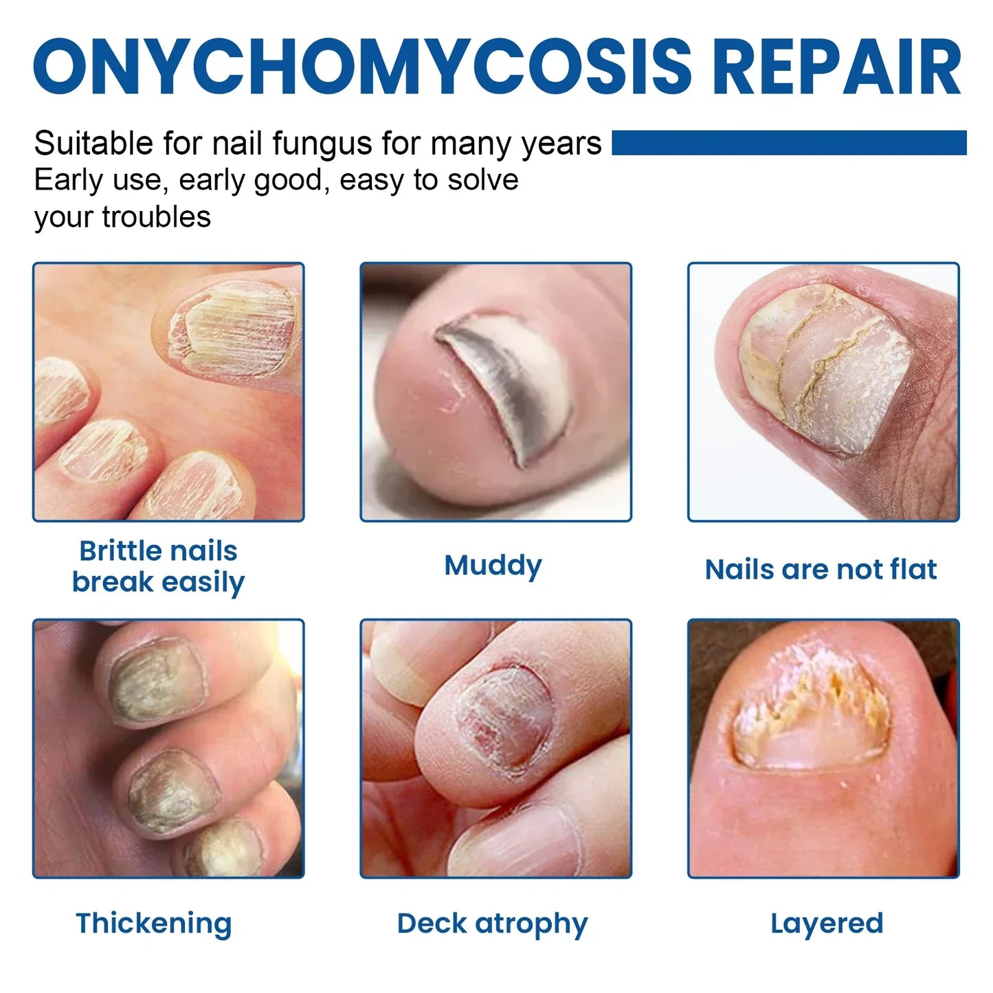 Fungus Nail Repair Patches